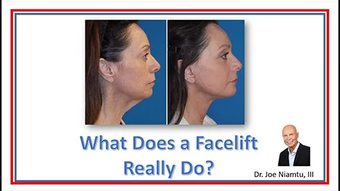 Dr Niamtu’s Facelift Videos Richmond | The Truth of Facelift Surgery